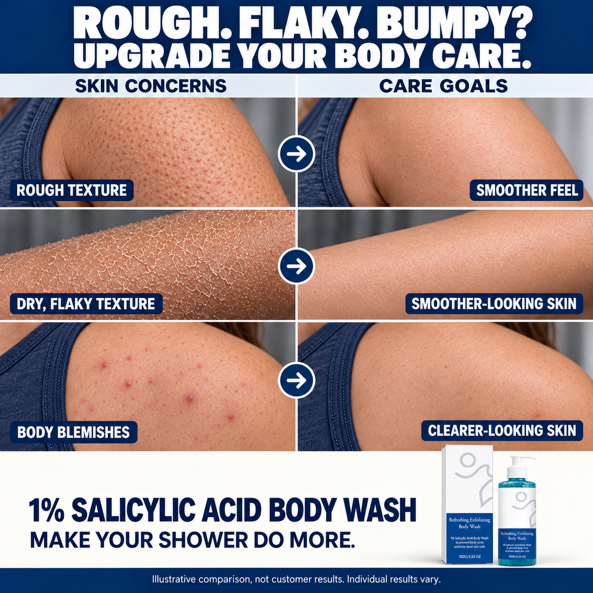 🔥 Flash Sale 🔥 Salicylic Acid Exfoliating Body Wash 🚿 Smoothing for Keratosis Pilaris & Body Acne-JR-8RH7
